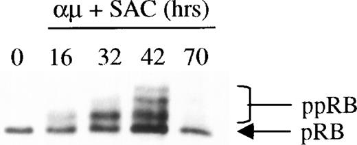 Fig. 2. Expression and phosphorylation of pRB in stimulated human B cells. Freshly isolated human B cells (1.5 × 106cells/mL) were stimulated with a combination of μ (37 μg/mL) and SAC (0.005%) for the indicated times. Total cell lysates were prepared and 30 μg per lane was subjected to Western blot analysis as described in Material and Methods. Hypophosphorylated pRB and hyperphosphorylated pRB (ppRB) were detected with the RB-PMG3-245 monoclonal antibody. The lane indicated as 0 hrs refers to a sample harvested before mitogenic stimulation of the cells. μ, F(ab′)2 fragment of rabbit antihuman IgM; SAC,Staphylococcus aureus crude cell suspension.