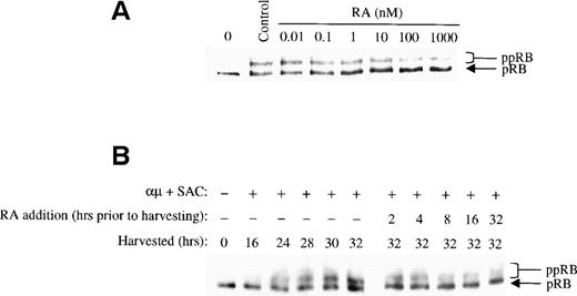 Fig. 3. Retinoic acid inhibits pRB phosphorylation. (A) Human B cells (1.5 × 106 cells/mL) were stimulated with μ (37 μg/mL) and SAC (0.005%) for 32 hours in the absence (control) or presence of retinoic acid at the indicated concentrations. Total cell lysates were prepared and 30 μg of total protein was analyzed for pRB protein by Western blotting. The lane indicated as 0 hrs refers to a sample harvested before mitogenic stimulation of the cells. (B) Left panel: Cells (1.5 × 106 /mL) were stimulated with μ (37 μg/mL) and SAC (0.005%) and harvested at the indicated times after stimulation. Right panel: Cells were stimulated with μ (37 μg/mL) and SAC (0.005%). Retinoic acid (1000 nmol/L) was then added to the cell cultures at each indicated time before harvesting the cells at 32 hours. Total cell lysates were prepared and subjected to Western blot analysis for pRB. μ, F(ab′)2 fragment of rabbit antihuman IgM; SAC, Staphylococcus aureus crude cell suspension; RA, retinoic acid.