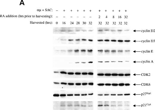 Fig. 5. Effect of retinoic acid on the expression of various cell cycle regulatory proteins in human B cells. (A) Mitogenic stimulation and retinoic acid treatment of the cells were performed as described in the legend to Fig 3B. Total cell lysates were prepared and equal amounts of total protein (60 μg) were subjected to Western blot analysis with antibodies against the proteins indicated on the right. (B) Cells (1.5 × 106 cells/mL) were stimulated for 16 or 24 hours before addition of retinoic acid (1000 nmol/L). The cells were then treated with retinoic acid for the indicated times and analyzed for the expression of p21Cip1 by Western blot analysis. μ, F(ab′)2 fragment of rabbit antihuman IgM; SAC, Staphylococcus aureus crude cell suspension; RA, retinoic acid.