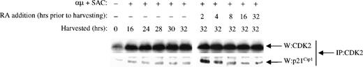 Fig. 7. Retinoic acid induces a transient increase in the association of p21Cip1 with CDK2 complexes. Mitogenic stimulation and retinoic acid treatment of the B cells were performed as described in the legend to Fig 3B. Whole cell extracts were immunoprecipitated with antibody against CDK2. The immunoprecipitates were then examined for CDK2 (top) and p21Cip1 (bottom) levels by Western blot analysis. IP, immunoprecipitating antibody; W, Western blot antibody; μ, F(ab′)2 fragment of rabbit antihuman IgM; SAC, Staphylococcus aureus crude cell suspension; RA, retinoic acid.