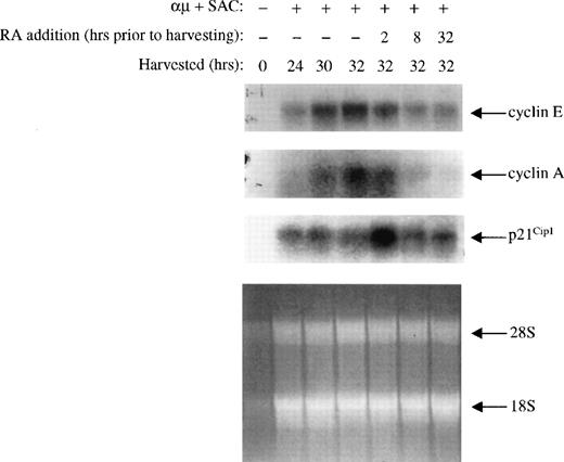 Fig. 8. Effect of retinoic acid on cyclin E, cyclin A, and p21Cip1 mRNA expression. Mitogenic stimulation and retinoic acid treatment of the B cells were performed as described in the legend to Fig 3B. mRNA from 25 × 106 cells was extracted and analyzed by Northern blotting using 32P-labeled cyclin E, cyclin A, and p21Cip1 probes as described in Materials and Methods. As a loading control we have shown the residual rRNA levels present in the different lanes. μ, F(ab′)2fragment of rabbit antihuman IgM; SAC, Staphylococcus aureuscrude cell suspension; RA, retinoic acid.