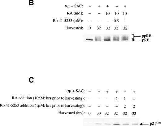 Fig. 10. The RAR-selective antagonist Ro 41-5253 blocks the effects of retinoic acid. (A) The effect of Ro 41-5253 on DNA synthesis was measured as described in Materials and Methods, using Ro 41-5253 at a concentration of 1 μmol/L, and retinoic acid at the concentration of 10 nmol/L. (B) B cells (1.5 × 106/mL) were stimulated with μ (37 μg/mL) and SAC (0.005%) for 32 hours in the absence or presence of retinoic acid (10 nmol/L). For Ro 41-5253 treatment of the cells, Ro 41-5253 (0.5 or 1 μmol/L) was added to the cell cultures alone or together with retinoic acid and the cells were harvested at 32 hours. Total cell lysates were prepared and subjected to Western blot analysis for pRB as described in Material and Methods. (C) Ro 41-5253 (1 μmol/L) was added to the cell cultures alone or together with retinoic acid (10 nmol/L) at the indicated times before harvesting the cells at 32 hours. Total cell lysates were prepared and subjected to Western blot analysis for p21Cip1. μ, F(ab′)2 fragment of rabbit antihuman IgM; SAC,Staphylococcus aureus crude cell suspension.