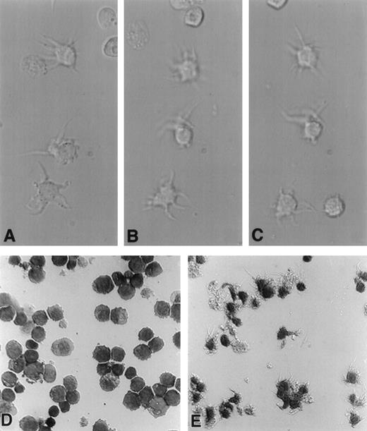 Fig. 2. A23187-treated HL-60 cells display progressive acquisition of dendritic processes. HL-60 cells (1 × 106) were cultured in a final volume of 2 mL with or without an optimal dose of A23187 (180 ng/mL) for up to 96 hours. Cells were harvested at 24 or 96 hours, resuspended in fresh medium, transferred to polylysine-coated glass chamber slides, and incubated an additional 20 minutes at 37°C. Cells were either immediately examined microscopically (600×) and photographed using DIC (Nomarski) optics (A, B, and C), or were fixed in 100% ethanol, stained in Wright’s solution, and then photographed (D and E). Photomicrographs A, B, and C were taken at consecutive 30-second intervals and depict living HL-60 cells treated with A23187 for 20 hours. Note motility of dendritic processes. Photomicrographs D and E depict fixed, stained, HL-60 cells previously left untreated (D) or treated with ionophore for 96 hours (E).
