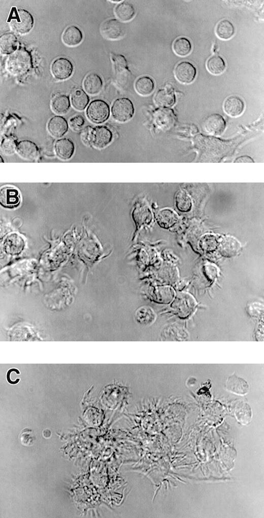 Fig. 5. Cultured CD34pos bone marrow cells acquire the capacity to form dendritic processes in response to treatment with A23187 or rhCD40L. Cultures of CD34pos bone marrow cells initially expanded for 6 days in the presence of rh-c-kit ligand, rhGM-CSF, and rhTNF- to induce numerical expansion. Cells were then centrifuged and replated in identical fresh medium except for the absence of rh-c-kit ligand, with individual wells also receiving CI A23187 or rhCD40L. Twenty hours after replating, cells were harvested and centrifuged, resuspended in fresh medium and transferrred onto polylysine-coated glass chamber slides, incubated for an additional 20 minutes at 37oC, and photomicrographed (600×) using DIC (Nomarski) optics. Photomicrographs are representative of multiple CI and CD40L doses tested in two separate experiments: untreated cells (A); cells treated for 20 hours with 375 ng/mL CI A23187 (B); cells treated for 20 hours with 10 μg/mL rhCD40L (C). Note dendritic processes exhibited on cells in panels B and C that are largely absent in A. Similar results were observed after CI treatment at 180 ng or 750 ng/mL or rhCD40L at 2.5 or 40 μg/mL (not shown).