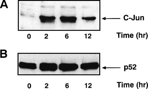 Fig. 4. c-Jun protein levels increase after stimulating primary human tonsillar B cells with the CD22 MoAb HB22.23. (A) Tonsil B cells were stimulated as described in Fig 3. Nuclear extracts were prepared, analyzed by immunoblotting with anti–c-Jun antisera, and detected by ECL. (B) The immunoblot described above was stripped and reprobed with anti-p52 NF-κB MoAb and detected by ECL.
