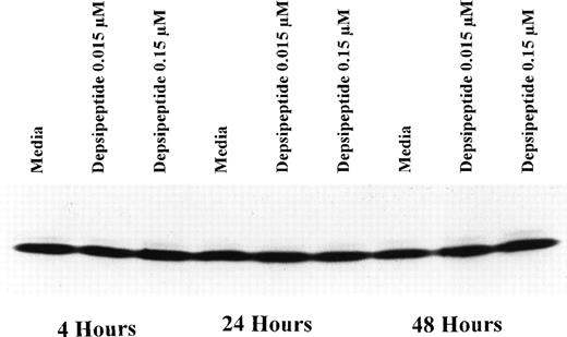 Fig. 3. Expression of bcl-2 protein in human CLL cells at 4, 24, and 48 hours after incubation with medium or 0.15 or 0.015 μmol/L of depsipeptide. The cells were obtained from CLL patients after informed consent was obtained, were isolated, and were cultured at 5 × 106/mL in medium or depsipeptide. Cell lysates were prepared and protein concentration was quantified using the BCA method (Pierce). Two micrograms of protein per lane from the CLL cell lysates was loaded onto a 10% sodium dodecyl sulfate-polyacrylamide gel electrophoresis (SDS-PAGE) gel and electrophoresed. Bcl-2 protein was detected using an anti–bcl-2 monoclonal antibody (Dako). Lane equivalent loading was verified by assessment with Fast Green staining (not shown).