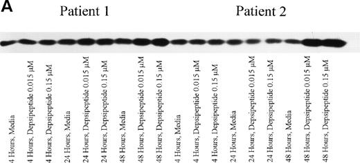 Fig. 4. (A) Expression of bax protein in human CLL cells at 4, 24, and 48 hours after incubation with medium or 0.15 or 0.015 μmol/L of depsipeptide. The cells were obtained from CLL patients after informed consent was obtained, were isolated, and were cultured at 5 × 106/mL in medium or depsipeptide. Cell lysates were prepared and protein concentration was quantified using the BCA method (Pierce). Two micrograms of protein per lane from the CLL cell lysates was loaded onto a 10% SDS-PAGE gel and electrophoresed. Bcl-2 protein was detected using an anti–bcl-2 monoclonal antibody (Dako). Lane equivalent loading was verified by assessment with Fast Green staining (not shown). (B) Expression of total protein on nitrocellulose membrane for gel (A) after staining with Fast Green. This demonstrates equivalent lane loading for each of the time points outlined in (A).