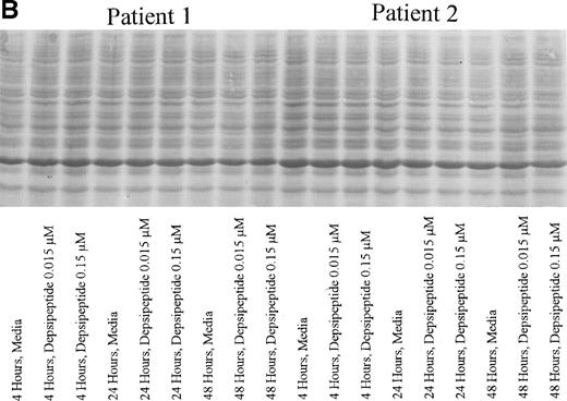 Fig. 4. (A) Expression of bax protein in human CLL cells at 4, 24, and 48 hours after incubation with medium or 0.15 or 0.015 μmol/L of depsipeptide. The cells were obtained from CLL patients after informed consent was obtained, were isolated, and were cultured at 5 × 106/mL in medium or depsipeptide. Cell lysates were prepared and protein concentration was quantified using the BCA method (Pierce). Two micrograms of protein per lane from the CLL cell lysates was loaded onto a 10% SDS-PAGE gel and electrophoresed. Bcl-2 protein was detected using an anti–bcl-2 monoclonal antibody (Dako). Lane equivalent loading was verified by assessment with Fast Green staining (not shown). (B) Expression of total protein on nitrocellulose membrane for gel (A) after staining with Fast Green. This demonstrates equivalent lane loading for each of the time points outlined in (A).