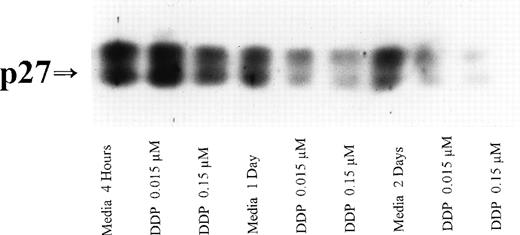 Fig. 5. Expression of p27 protein in human CLL cells at 4, 24, and 48 hours after incubation with medium or 0.15 and 0.015 μmol/L of depsipeptide. The cells were obtained from CLL patients after informed consent was obtained, were isolated, and were cultured at 5 × 106/mL in medium or depsipeptide. Cell lysates were prepared and protein concentration was quantified using the BCA method (Pierce). Five micrograms of protein per lane from the CLL cell lysates was loaded on a 10% SDS-PAGE gel and electrophoresed. The p27 protein was detected using an anti-p27 polyclonal antibody (Oncogene). Lane equivalent loading was verified by assessment with Fast Green staining (not shown).