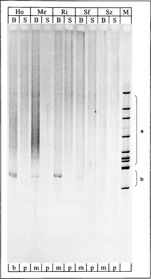 Fig. 2. Temperature-gradient gel of TCRγ PCR products. Lane 1-10, PCR products derived from blood and skin samples of SPP patients HO, ME, RI, SF, and SZ; all blood samples showed clonal PCR products. Lane 11, Hinc II digest of phi X174. S, skin sample; B, blood sample; M, marker (Hinc II digest of phi X 174); b, biallelic (or biclonal); m, monoclonal; p, polyclonal; a, range of polyclonal smears;b, range of clonal bands.