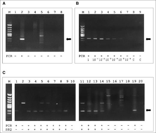 Fig. 3. (A) Agarose gel of products of the clone-specific PCR using primer BE-1. Lane 1, skin sample DNA of BE; 2, blood sample DNA of BE; 3-5, skin sample DNA from CTCL patients (tester DNA); 6-8, blood sample DNA from CTCL patients (tester DNA). A specific PCR product (indicated by the arrow) is observed exclusively in lane 2. The additional band in lanes 2 and 5 represents a larger PCR product that, according to the size, is referred to as an unspecific amplificate. (B) Agarose gel of the sensitivity assay using primer JU-5 and 10-fold dilution of JM cell line DNA in PBMC from a healthy donor. A specific PCR product (indicated by the arrow) is found up to the dilution of 10 JM cells in 106 PBMC (10-5) in lane 6. (C) Results of the analysis of the fractionated clones (1-14, established from patient HO; 15-20, from BE): fraction A was sequenced directly, fraction B was amplified by clone-specific PCR using primer HO-2 and separated on an agarose gel. Nonconcordance between PCR and sequencing is observed in lane 1 and 19. M, marker (Hinc II digest of phi X 174); PCR, PCR result; SEQ, result of sequencing; +, PCR product of expected size/sequence identical to the second allel of patient HO; −, no PCR product of expected size/sequence not identical to the second allele of patient HO.