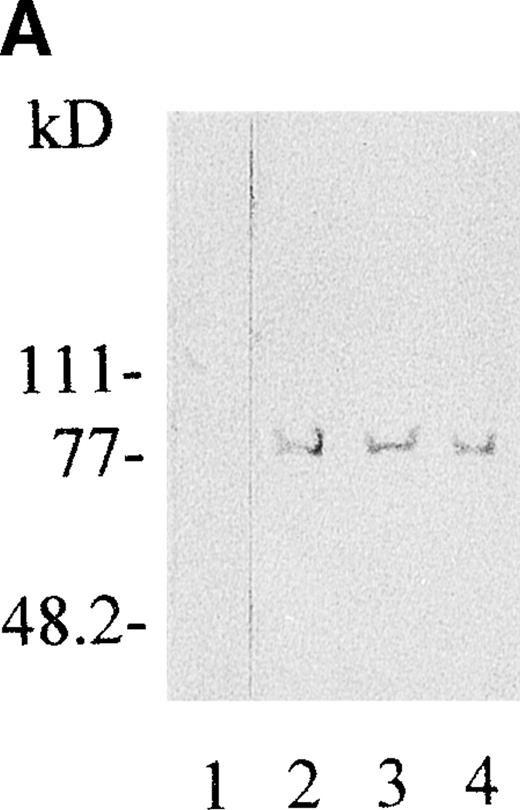 Fig. 3. Western immunoblots of expressed s-Kell. The left panel shows Western immunoblots with a rabbit polyclonal antibody to human Kell protein. Proteins present in the media from sf9 cells expressing wild-type, Jsa Kell phenotype and E582G mutant s-Kell were separated by SDS-PAGE. Molecular size markers are shown. Lane 1 is a control from medium of sf9 cells that were not infected. Lane 2 is medium from cells expressing from wild-type s-Kell. Lane 3 has medium from cells expressing Jsa Kell phenotype and lane 4 has medium from those expressing E582G mutant. The right panel shows proteins isolated on nickel columns eluted with imidazole and analyzed as described above. Lane 1 is from cells expressing Jsa Kell phenotype, lane 2 is from cells expressing wild-type, and lane 3 is from cells expressing the E582G mutant. Lane 4 is a control from uninfected sf9 cells.