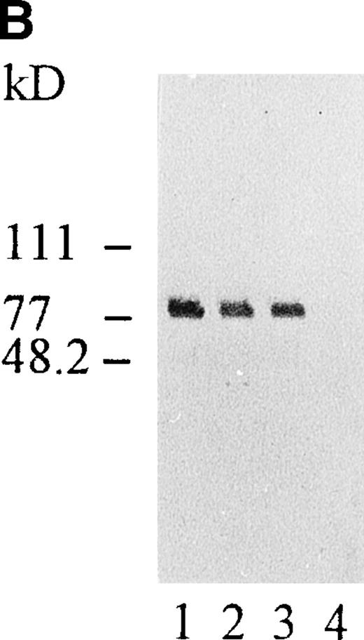 Fig. 3. Western immunoblots of expressed s-Kell. The left panel shows Western immunoblots with a rabbit polyclonal antibody to human Kell protein. Proteins present in the media from sf9 cells expressing wild-type, Jsa Kell phenotype and E582G mutant s-Kell were separated by SDS-PAGE. Molecular size markers are shown. Lane 1 is a control from medium of sf9 cells that were not infected. Lane 2 is medium from cells expressing from wild-type s-Kell. Lane 3 has medium from cells expressing Jsa Kell phenotype and lane 4 has medium from those expressing E582G mutant. The right panel shows proteins isolated on nickel columns eluted with imidazole and analyzed as described above. Lane 1 is from cells expressing Jsa Kell phenotype, lane 2 is from cells expressing wild-type, and lane 3 is from cells expressing the E582G mutant. Lane 4 is a control from uninfected sf9 cells.