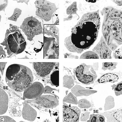 Fig. 1. (A) Polychromatophilic normoblast and reticulocyte in bone marrow of SAD mouse. Parallel bundles of polymer fibers are noted in the cell periphery (arrow) of polychromatophilic normoblast and in cytoplasm of reticulocyte (arrowhead; original magnification × 6,372). Inset shows polymer bundles (star) in the cytoplasm as well as in the interchromatin regions of the extruding nucleus (original magnification × 18,720). (B) Polychromatophilic normoblast in bone marrow of SAD mouse showing cytoplasmic and nuclear polymer bundles with indentation of the nuclear envelope (original magnification × 10,000). (C) Reticulocyte in bone marrow of SAD/βd3 mouse migrating through narrow gap in sinusoidal endothelium (SE). Polymers are restricted to the extravascular portion of the cytoplasm (arrow) compared with the intravascular portion (arrowhead) of a markedly deformed reticulocyte. An erythroid cell fragment (black star) is present next to migrating reticulocyte. A dense chromatin-like cap, probably a retained nuclear fragment, is seen involving part of the cell periphery of a polymerized reticulocyte (white star). No polymers are seen in intravascular erythrocytes. (original magnification × 7,500). (D) Reticulocyte traversing a wide gap in the sinusoidal barrier (SE), showing pointed extensions with polymer bundles oriented in the direction of the flow (arrow). A large geometric conglomerate of polymer bundles is seen in adjacent extravascular reticulocytes (arrowhead). Reticulocyte fragments (black star) are present next to reticulocyte in process of migrating through a narrow gap. Polymers are absent in the intravascular erythrocyte (original magnification × 3,000).