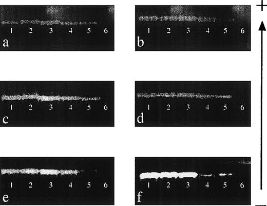 Fig. 1. Sensitivity of nested PCR-SSP typing for HLA class I alleles. (a) Primer mix (PM) 151 (A*0101-4N); (b) PM 9 (A*2501-2, A*2601-11N, A*3401-2, A*6601-3); (c) PM 155 (B*0801-3); (d) PM 47 (B*1301-3); (e) PM 86 (Cw*0102-3); and (f) PM 106 (Cw*1502-6). DNA of known HLA type (200 ng/μL) was mixed with an irrelevant DNA (200 ng/μL) to give relative final concentrations of 10% (lane 1), 1% (lane 2), 0.1% (lane 3), 0.01% (lane 4), and 0.001% (lane 5). Lane 6 is a specificity control in which the irrelevant DNA was amplified on its own. Each mix was then subject to a primary amplification with the appropriate set of first-round primers.28 The resultant product was diluted 1:500 in water before PCR-SSP typing using the method of Bunce et al.19 The gel is run from negative (−) to positive (+). Sensitivity experiments were performed on 3 occasions, and each primer mix was reproducibly capable of detecting DNA at a final concentration of 0.001%.