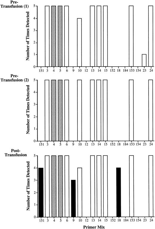 Fig. 3. Validation of nested PCR-SSP typing. Recipient 01 (HLA-A type: A*0301, A*2402) was transfused with fresh blood from 2 healthy, HLA-typed volunteers (donor 1: A*0101; donor 2: A*2501, A*3002). The bar graph shows the results of amplification of 2 pretransfusion samples and a posttransfusion sample by primer mixes for the HLA-A locus alleles used in this system (Table 2). Analysis of both pretransfusion samples produces a similar pattern of amplification in which primer mixes 4 and 5 represent recipient alleles (A*0301) and (A*2402), respectively (dark shading). Potentially informative primer mixes are those that do not give rise to nonspecific products in any of the multiple tests of the pretransfusion samples. In this case, these are primer mixes 151, 9, 12, 152, 18, 184, and 154. Analysis of the posttransfusion samples shows additional amplification with primer mix 151, which is indicative of donor 1 (A*0101), and primer mixes 9 and 18, which are both indicative of donor 2 (A*2501 and A*3002, respectively; hatched shading). Primer mixes 3, 6, 10, 13, 14, 15, 153, 23, and 24 detect nonspecific products in the pretransfusion samples and thus are noninformative in the analysis of posttransfusion samples (light shading). The requirement for testing pretransfusion samples is demonstrated by the results with primer mix 10, which potentially should amplify A*2501 from donor 2. In this example, although there was amplification in the posttransfusion sample, the reaction has to be excluded from the analysis because of the nonspecific amplification present in the pretransfusion samples.
