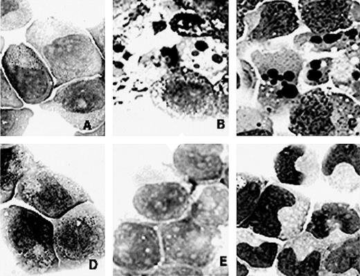 Fig. 1. Morphology of NB4 (A, B, and C) and NB4/As (D, E, and F) cell lines on RA or the combination of RA and As2O3 treatment. (A and D) Before treatment. (B and E) After 1 day of treatment with 1 μmol/L As2O3. (C) After 1 day of treatment with 1 μmol/L all-trans RA and 1 μmol/L As2O3. (F) After 4 days of treatment with 1 μmol/L RA and 1 μmol/L As2O3.