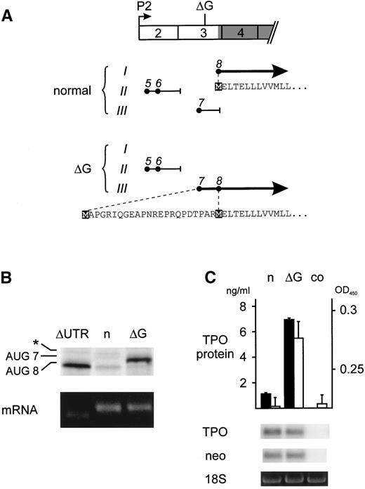 Fig. 1. Analysis of the translational efficiency of normal and mutant TPO transcripts in reticulocyte lysates. (A) Exon composition and ORFs of the normal and mutant TPO mRNAs originating from promoter 2 (P2). Exons are drawn as numbered boxes and the TPO protein coding region is shaded. The position of the single G nucleotide deletion is indicated (▵G). The patterns of uORFs are drawn separately for normal and mutant TPO mRNA. The uAUG codons (•) are placed in the 3 possible reading frames (Roman numbers) and numbered in the order in which they appear in the full-length P1 transcript. The resulting uORFs are shown as horizontal lines and the position of stop codons is indicated by short vertical lines. Thick solid lines with arrowheads represent the normal and ▵G-mutant TPO-ORFs, with the corresponding amino acid sequences indicated below. Initiator methionines are highlighted by black boxes. (B) In vitro transcription-translation analysis of mRNAs originating from P2. Equal amounts of in vitro-transcribed TPO mRNA variants (lower panel) were translated in vitro in reticulocyte lysate in the presence of 35S-methionine (upper panel). ▵UTR, mRNA with deletion of the entire 5′-UTR; n, normal mRNA; ▵G, ▵G-mutant mRNA. The protein bands in the upper panel were AUG8, the normal TPO protein initiated at the physiological start site; AUG7, mutant TPO protein originating from AUG7; asterisk, cryptic non-AUG initiation in exon 3. (C) TPO secretion by COS cells transfected with either the normal (n) or ▵G-mutant (▵G) TPO cDNA. TPO protein concentration in COS cell supernatants was determined by ELISA (▪) and by bioassay (□). Error bars represent the standard deviations. co, supernatant from nontransfected COS cells. The abundance of transfected TPO mRNA was assessed by Northern blot. To confirm equal transfection efficiencies, mRNA for vector-derived neomycin resistance gene (neo) was determined by reprobing of the Northern blot and equal RNA loading was verified by visualizing the 18S ribosomal RNA with ethidium bromide staining (lower panels).