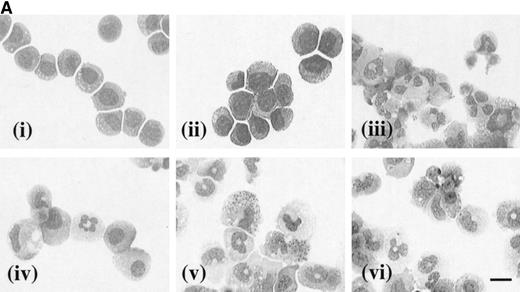 Fig. 6. (A) Morphology of hIL-3 R,βc cells and hGM R,βc cells in culture. Cells expressing hIL-3 R,βc were cultured in (i) hIL-3 (10 ng/mL) alone or (ii) hIL-3 (10 ng/mL) in combination with murine cytokines that promote granulocyte-macrophage differentiation. Cells expressing hGM R,βc were cultured in (iv) hGM-CSF (10 ng/mL) alone or (v) hGM-CSF (10 ng/mL) in combination with granulocyte-macrophage differentiation conditions. Panels (iii) hIL-3 R,βccells and (vi) hGM-CSF R,βc cells show the morphology of cells cultured in granulocyte-macrophage differentiation conditions for comparison. Cytospin samples of cells were prepared after 7 days in culture and the morphology examined after May-Grunwald-Giemsa staining. Bar, 10 μm. Results are from an experiment representative of 3. Similar results were obtained with at least 3 clones of each transfect. (B) Dose-response of hIL-3 and hGM-CSF effects on morphology of hIL-3 R,βc cells and hGM R,βc cells respectively in culture. Cells expressing (i) hIL-3 R,βc or (ii) hGM R,βc were cultured in hIL-3 or hGM-CSF (0.1 to 100 ng/mL), respectively. Cytospin samples of cells were prepared after 7 days in culture and the morphology examined after May-Grünwald-Giemsa staining. Results are expressed as cell morphology (percentage of total cells scored). Cells were scored as blast, early granulocyte (EG), late granulocyte (LG), or macrophage (m/phage). Results are from a single experiment representative of 3. Similar results were obtained with at least 3 clones of each transfect.