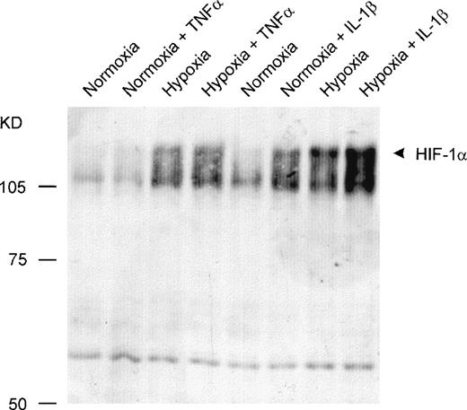 Fig. 3. Detection of HIF-1 protein by Western blot analysis. Twenty micrograms of nuclear protein per lane was sufficient for detection by a monoclonal anti–HIF-1 antibody. IL-1β caused an accumulation of HIF-1 protein in nuclei from HepG2 cells under normoxic and hypoxic conditions. TNF- was ineffective.