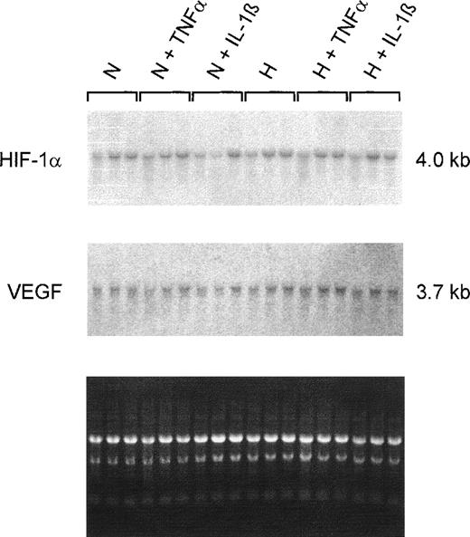 Fig. 5. Northern hybridizations with HIF-1– and VEGF-specific probes on total RNAs from HepG2 cells. Cultures were grown in conventional culture dishes to 20%-30% confluence. Normoxic cells (N) were incubated in 20% O2 and hypoxic cells (H) in 3% O2 for 4 hours with TNF 10 ng/mL or IL-1β 300 pg/mL. The ethidium bromide fluorescence of the RNA is shown at the bottom. Neither of the 2 cytokines had an effect on HIF-1 or VEGF mRNA levels after 4 hours of incubation.