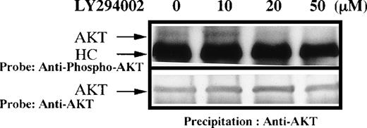 Fig. 7. (A) Phosphorylation of AKT in human erythroid cells stimulated by EPO (10 U/mL). Day 8 cells were washed once in IMDM and lysed by adding an equal amount of a buffer containing 2% Triton X-100 after incubation for 1 hour in the presence of DMSO or various concentrations of LY294002. AKT was immunoprecipitated with specific AKT antisera. Immune complexes were resuspended in SDS-sample buffer and divided into two. Phosphorylation of AKT was detected using an anti-phospho-AKT antibody (A), and total AKT was detected using an anti-AKT polyclonal antibody (B). Bands were visualized by chemiluminescence.