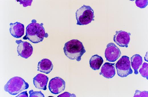 Fig. 1. PB CD34+ cells cultured for 8 days with SCF, IL-3, and EPO (day 8 cells). May-Grünwald staining (original magnification ×1,000).