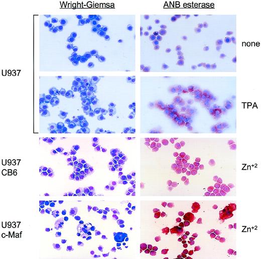 Fig. 2. Morphologic and lineage analysis of cloned U937 cell lines conditionally expressing c-Maf. Cytospin preparations of parental U937 cells either untreated (top row) or treated with TPA (second row); or U937 clonal lines containing either vector control (U937 CB6, third row) or c-Maf expression constructs (U937 c-Maf, bottom row) incubated for 48 hours with 150 μmol/L ZnSO4. Left column: Wright-Giemsa stain for morphological examination; right column: -napthyl butyrate esterase stain specific for monocytic lineage.