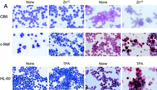 Fig. 3. Analysis of cloned HL-60 cell lines conditionally expressing c-Maf. (A) Lineage analysis of stable HL-60 lines expressing c-Maf. Cell lines containing either vector control (CB6, top row) or c-Maf (c-Maf, middle row) were untreated (none) or incubated with 150 μmol/L ZnSO4 (Zn+2), or parental HL-60 cells (bottom row) were untreated (none) or TPA treated (TPA). Cytospin preparations were stained with Wright-Giemsa (left two panels) or -napthyl butyrate esterase monocyte-specific stain (right two panels). (B) Conditional expression of c-Maf over time. Individual HL-60 clonal cell lines containing either CB6 vector (HL-60 CB6 clone 3) or CB6-c-Maf-(HL-60 c-Maf clones 4 and 6) were induced with ZnS04 for the indicated time periods and lysates were probed for c-Maf expression with an antiserum recognizing the c-Maf protein. (C) Induction of c-Maf alters normal growth kinetics. Viable cell numbers were determined for vector control-containing (CB6) or c-Maf–containing (c-Maf clones 4 and 6) stable cell lines by trypan blue dye exclusion at the indicated intervals after zinc exposure. Representative data from 2 individual experiments are presented.