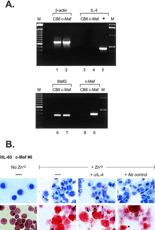 Fig. 5. IL-4 expression is not induced in c-Maf–expressing cell lines. (A) IL-4 mRNA is not induced on c-Maf protein expression. RT-PCR analysis of cDNA templates from induced CB6 vector control (lanes 1, 3, 6, and 8) or c-Maf-containing clone 6 (c-Maf, lanes 2, 4, 7, and 9) using primer pairs detecting β-actin control (lanes 1 and 2), IL-4 (lanes 3 to 5), MafG (lanes 6 and 7), or c-Maf (lanes 8 and 9). M, marker lanes; +, IL-4 positive control DNA template. (B) IL-4 neutralizing antibodies do not affect c-Maf–induced monocytic differentiation. Neutralizing antibodies directed against IL-4 or isotype-matched control antibodies were added to cultures of HL-60 c-Maf clone 6 cells at the time of zinc induction. Top row: Wright-Giemsa stain; bottom row: monocyte-specific ANB esterase stain of cytospin preparations.