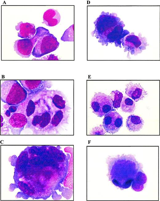 Fig. 9. Morphologic analysis of cells from liquid cultures. MGG staining of cytocentrifugated cells from PD98059-treated (A to C) or control (D to F) cultures, at day 10 (A and D) and day 13 (B, C, E, and F); original magnification × 100.