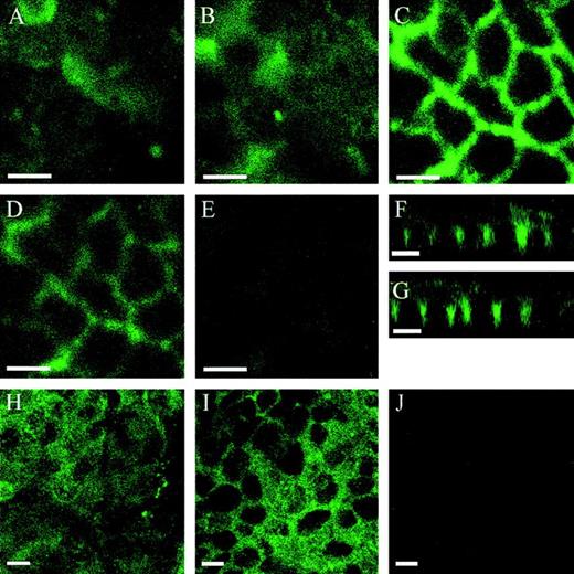 Fig. 2. TF localization on polarized Caco-2 cells. Cells were processed for indirect immunofluorescence with polyclonal rabbit anti-human TF IgG antibody followed by FITC-conjugated goat anti-rabbit antibody. Images were acquired by confocal microscopy as described in Materials and Methods. Cells were sectioned in the X-Y plane from the apical to basal membrane surfaces at 0.5-μm increments. Panels (A) through (G) represent nonpermeabilized cells. Panels (A) and (B) represent single focal X-Y planes at 2-μm increments around the apical membrane domain. Panels (C) and (D) represent single focal X-Y planes at 2-μm increments through the center of the cells. Panel (E) represents the basal membrane. Panels (F) and (G) show representative X-Z confocal views of nonpermeabilized cells. In panels (H) through (J), cells were permeabilized with 0.2% saponin. Panel (H) represents TF-specific staining of the apical membrane domain. Panel (I) represents mainly basolateral TF staining, 6 μm from plane in panel (H). Panel (J) represents TF staining of the basal membrane, 14 μm from plane in panel (H). Bars, 10 μm.