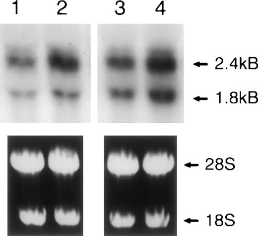 Fig. 5. Northern blot analysis of cytokine-induced DAF on HUVECs and DMECs. ECs were cultured for 6 hours in plain medium alone or supplemented with a combination of TNF- (10 ng/mL) and IFN-γ (500 U/mL). Total RNA was isolated and Northern blots were prepared. Lane 1, unstimulated DMECs; lane 2, TNF- and IFN-γ–stimulated DMECs; lane 3, unstimulated HUVECs; lane 4, TNF- and INF-γ–stimulated HUVECs. The ethidium bromide–stained gel confirmed equal loading of RNA in each lane. These findings were confirmed in 3 separate experiments.