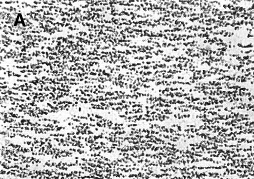 Fig. 6. The effect of the S-nitroso-AR545C or AR545C on platelet interaction with ECM under flow conditions (shear rate of 1,300 s−1). Citrated whole blood (0.25 mL) was tested in the cone-plate viscometer analysis system after a 10-minute preincubation with either control buffer, 1.5 μmol/L AR545C, or 1.5 μmol/L S-nitroso-AR545C, and shown in representative field of the video screen (A, B, and C, respectively). The corresponding frequency histograms (D, E, and F, respectively) for the size distribution of the adhered platelets and platelet aggregates are also depicted.