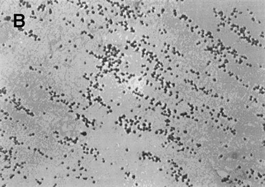 Fig. 6. The effect of the S-nitroso-AR545C or AR545C on platelet interaction with ECM under flow conditions (shear rate of 1,300 s−1). Citrated whole blood (0.25 mL) was tested in the cone-plate viscometer analysis system after a 10-minute preincubation with either control buffer, 1.5 μmol/L AR545C, or 1.5 μmol/L S-nitroso-AR545C, and shown in representative field of the video screen (A, B, and C, respectively). The corresponding frequency histograms (D, E, and F, respectively) for the size distribution of the adhered platelets and platelet aggregates are also depicted.