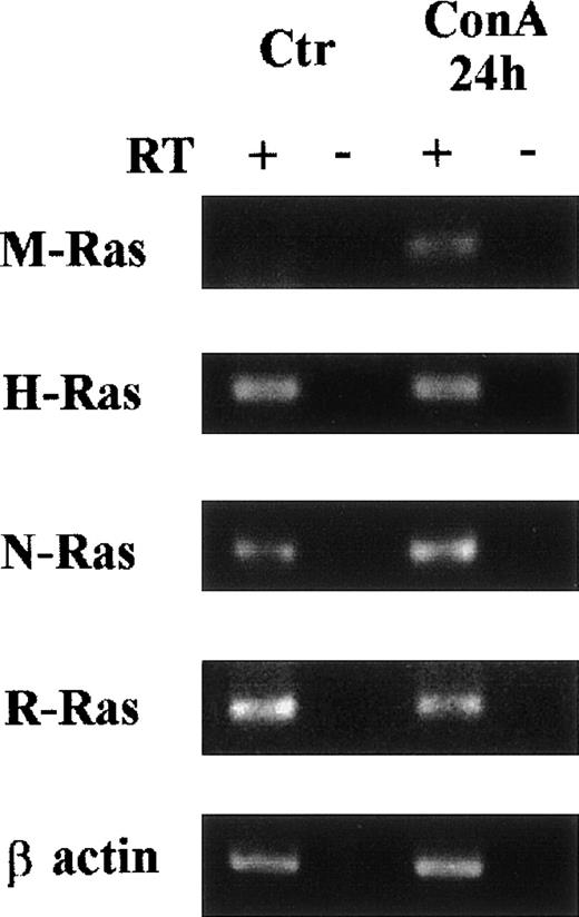 Fig. 5. Induction of M-Ras expression by ConA stimulation of freshly isolated spleen cells. Spleen cells were cultured for 24 hours with or without ConA (5 μg/mL). Total RNA was extracted and RT-PCR amplification was performed as described for Fig 2. Samples where the reverse transcriptase (RT) was omitted were used as negative controls for each condition. The post-PCR products were analyzed in ethidium bromide–stained 1.5% agarose gel.