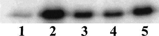 Fig. 4. Activation of IKK and IKKβ in human monocytic THP-1 cells by LPS derived from different gram-negative bacteria. Lane 1, Unstimulated cells; Lane 2, LPS from E coli 0127:B8 extracted by Boivin method (DIFCO); Lane 3, LPS from E coli 0127:B8 prepared by phenol extraction and gel filtration chromatography (Sigma); Lane 4, LPS from P aeruginosa serotype 10. LPS fromS minnesota. Human monocytic THP-1 cells were stimulated with different preparations of LPS at 1 μg/mL for 30 minutes and the IKK kinase assay was done as specified in Materials and Methods.The kinase complex was immunoprecipitated with anti-IKKβ antibody.