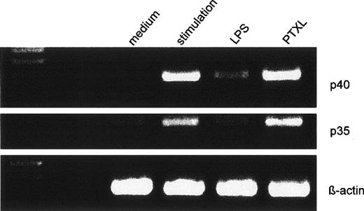 Fig. 7. Effects of LPS or PTXL pretreatment on the mRNA expression for IL-12p40 and p35 in human monocytes. Human monocytes were preincubated with LPS (50 ng/mL) or PTXL (10 μmol/L) for 24 hours before stimulation with IFN-γ/LPS. Five hours after the stimulation procedure, mRNA was isolated and expression of p40, p35, and β-actin was determined by RT-PCR. The resulting cDNA fragments were resolved on a 2% agarose gel and visualized by ethidium bromide. The amplified cDNA fragments had the expected lengths of 290 bp for p40, 414 bp for p35, and 225 bp for β-actin. One representative of 5 independent experiments is shown.