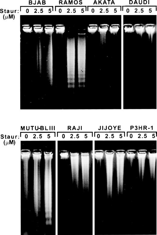 Fig. 2. Induction of apoptosis in Fas-resistant BL cell lines by staurosporine. Cells (1 × 106) were incubated with DMSO vehicle alone (0 μmol/L) or exposed to 2.5 and 5 μmol/L staurosporine for 16 hours and subsequently harvested for analysis of DNA fragmentation as described in Materials and Methods.