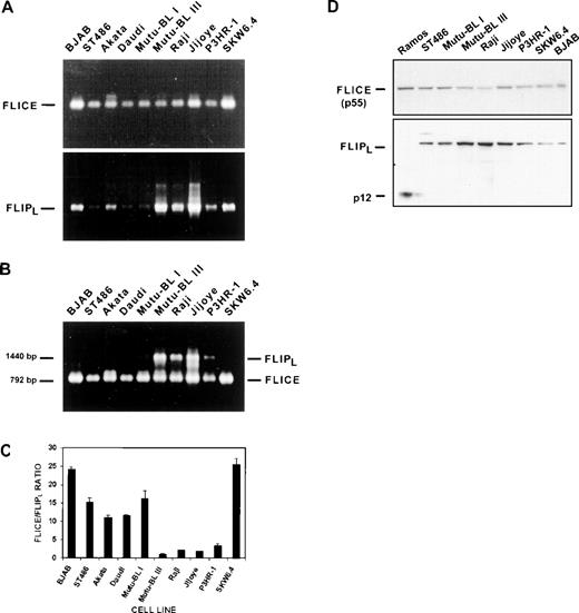 Fig. 7. FLIPL mediates Fas-resistance in EBV-positive Burkitt’s lymphoma cell lines. (A) FLIPL transcripts were detected by RT-PCR analysis of total RNA samples. The amplification product corresponding to the mature 1,440-bp coding sequence is indicated. Higher-molecular-weight products representing unprocessed transcripts were also detected and can be seen in the Mutu-BL III and Jijoye lanes. FLICE/caspase-8 transcript levels were determined with primers specific for the caspase-homology domain (792-bp). (B) Caspase-8/FLIPL competitive PCR analysis. FLIPLand FLICE/caspase-8 transcript levels were directly compared in the same sample by performing RT-PCR reactions containing primer pairs for both genes under conditions of limiting dNTPs. Gene-specific products and their sizes are indicated on the right and left, respectively. (C) The FLICE/FLIPL ratios were calculated from arbitrary values obtained by scanning densitometry of the gel from (B) and are graphically represented. Data were obtained from scans using 3 different exposures. Results are expressed as mean ± standard deviation and are representative of at least 3 separate experiments. (D) Direct comparison of FLICE/caspase-8 and FLIPL protein expression. Immunoblot analysis was performed on a panel of EBV-negative and EBV-positive BL cell lysates. The same membranes were used for analysis of both FLICE/caspase-8 and FLIPL by sequential antibody hybridizations. The 55-kD forms of both proteins are indicated, as well as the FLIPL p12 cleavage product predominant in the Ramos cell line.