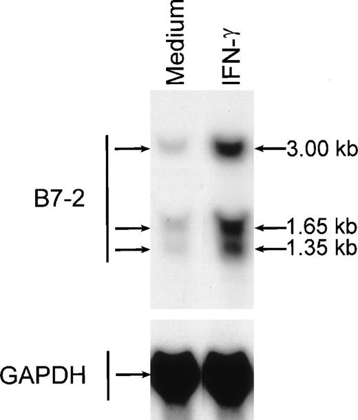 Fig. 1. IFN-γ treatment of MM6 cells increases B7-2 mRNA expression. MM6 cells were cultured for 18 hours in the absence or presence of 500 U/mL of IFN-γ. Total cellular RNA was extracted and analyzed by Northern blot for B7-2 mRNA expression. The same membrane was rehybridized with GAPDH to control that equal amounts of RNA were loaded in each lane. Data shown are from 1 representative experiment of 4 performed.