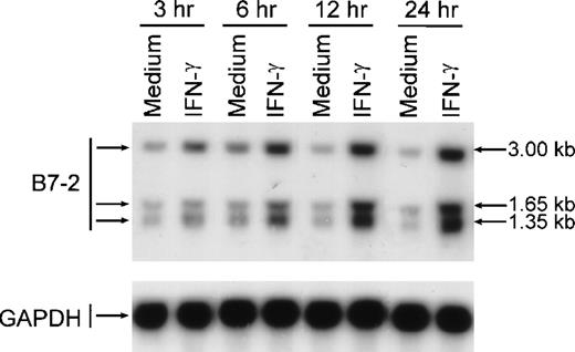 Fig. 3. Kinetics of IFN-γ–induced upregulation of B7-2 mRNA. MM6 cells were stimulated in the presence or absence of 500 U/mL of IFN-γ for the indicated times. Total cellular RNA was isolated, and Northern blot analysis for B7-2 mRNA expression was performed. The same filter was subsequently probed with GAPDH to ensure that comparable amounts of RNA were loaded in each lane. Data shown are from 1 representative experiment of 2 performed. Northern blot analysis for B7-2 mRNA expression (upper panel). Quantitative analysis of B7-2 mRNA expression (lower panel). As explained in Materials and Methods, the bands’ intensities were normalized to the GAPDH housekeeping gene control, and the graph was generated with the relative values obtained after normalization.