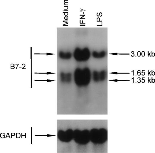 Fig. 8. IFN-γ treatment of human peripheral blood monocytes augments B7-2 mRNA expression. Human peripheral blood monocytes were cultured for 3 hours in medium alone or in the presence of either 500 U/mL of IFN-γ or 10 ng/mL of LPS. Total cellular RNA was extracted and analyzed by Northern blot for B7-2 mRNA expression. The same membrane was rehybridized with GAPDH to control that equal amounts of RNA were loaded in each lane. Data shown are from 1 representative experiment of 2 performed.