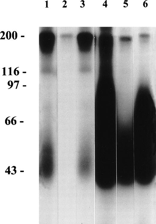 Fig. 1. Immune precipitation from 125I-labelled NA(1+,2+)-phenotyped neutrophils by neutrophil antisera and CD16 MoAbs. Lane 1, serum from the patient with the clinical pattern of primary AIN, but with chronic neutropenia. This serum reacted positively in the indirect GIFT and MAIGA with both NA(1+, 2−) and NA(1−, 2+)-phenotyped neutrophils. Lane 2, serum from a patient with secondary AIN with pan-FcγRIIIb antibodies as shown by the indirect GIFT. Lane 3, serum from a patient with primary AIN and NA1 antibodies, shown in the GIFT and the MAIGA. Lane 4, control serum containing isoantibodies with pan-FcγRIIIb specificity. Lane 5, MoAb CLB-gran11 (NA1-FcγRIIIb). Lane 6, MoAb CLB-FcRgran1 (pan-FcγRIIIb).