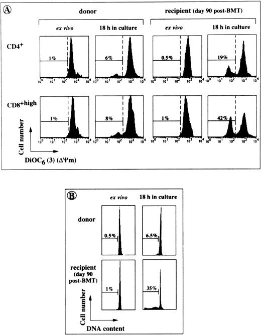 Fig. 3. Cytofluorometric analysis of accelerated spontaneous apoptosis affecting post-BMT T cells in short-term cultures. PBL from BMT patients and their donors were tested for apoptosis either directly after harvesting (ex vivo) or after an 18-hour incubation in culture medium. (A) A typical experiment performed with the cells of UPN 315 showing the percentages of cells with low ▵Ψm (DiOC6(3)low). (B) Percentages of hypodiploid cells detected in the same culture conditions by staining ethanol-permeabilized lymphocytes from UPN 294 with propidium iodide (linear scales are shown).