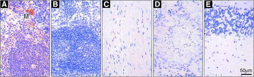 Fig. 6. Immunohistochemical detection of hCD4 in organs ofvav-hCD4 and control mice. (A) Transgenic spleen with a megakaryocyte (M); (B) nontransgenic spleen; (C) transgenic heart; (D) transgenic testis; and (E) transgenic cerebellum (other brain sections were also negative). Nontransgenic brain and testis were indistinguishable from those shown, and nontransgenic heart essentially so (see text).
