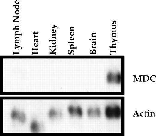 Fig. 3. Northern blot analysis of MDC expression in rat tissues. Total RNA was isolated from various rat tissues, fractionated on a formaldehyde agarose gel, and blotted onto nitrocellulose. The blot was hybridized sequentially with cDNA probes for MDC and β-actin. Probe removal was confirmed between each round of hybridization by autoradiography. Exposure times were 2 days for MDC and 8 hours for β-actin. The more rapidly migrating species present in heart represents hybridization of the β-actin probe to γ-actin, which is the major species of actin present in this tissue.27