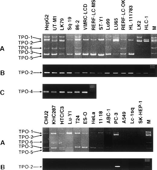 Fig. 2. TPO mRNA isoforms detected by RT-nested PCR. (A and B). Total RNA was reverse-transcribed and the first PCR (primer set S3 and A3) was performed. PCR products were subjected to nested-PCR using a set of S7 and A2 primers for TPO-1, TPO-2, TPO-3, TPO-5, and TPO-6 (A) or a set of S2 and A4 primers for TPO-2 (B). (C) Approximately 450 to 500 bp of the first PCR products was fractionated by electrophoresis, and then the second PCR using a set of S7 and A2 primers for TPO-4 was performed.