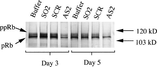 Fig. 7. Effects of AS2 on the production of pRb. Cells at an initial concentration of 5,000/mL were incubated in medium supplemented with FL at 50 ng/mL and IL-3 at 25 ng/mL to promote monocytic differentiation. Oligo buffer, sense-orientated oligonucleotides (SO2), scrambled oligonucleotides (SCR), or antisense RB oligonucleotides (AS2) were added on days 0, 5, and 10, each time at a concentration of 5.0 μmol/L. On days 3 and 5, 1.5 × 106 cells from each incubation were subjected to protein extraction, followed by specific immunoprecipitation with an anti-pRb antibody (sc-102; Santa Cruz), 6% SDS-PAGE, and Western blot analysis. pRb of different molecular weights are indicated with arrows (ppRb, hyperphosphorylated; pRb, hypophosphorylated).