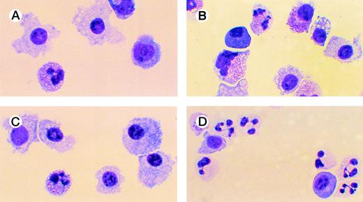 Fig. 5. Effects of oligonucleotides on differentiation of CD34+ cells induced with FL plus IL-3 assayed by morphology. Cells at an initial concentration of 5,000/mL were incubated in medium supplemented with FL at 50 ng/mL and IL-3 at 25 ng/mL to promote monocytic differentiation. On days 0, 5, and 10, antisense RB oligonucleotides (AS2), sense-orientated oligonucleotides (SO2), or scrambled oligonucleotides (SCR) were added, each time at a concentration of 5.0 μmol/L. After 14 days, cytospin slides were prepared and stained with May-Grünwald-Giemsa. Cells incubated with FL, IL-3, and oligo buffer (A); with FL, IL-3, and SO2 (B); with FL, IL-3, and SCR (C); or with FL, IL-3, and AS2 (D).